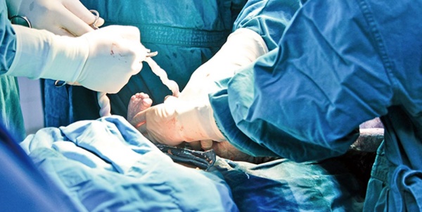 Bé trai 1 ngày tuổi không qua khỏi vì mẹ chọn sinh chủ động ở tuần 36