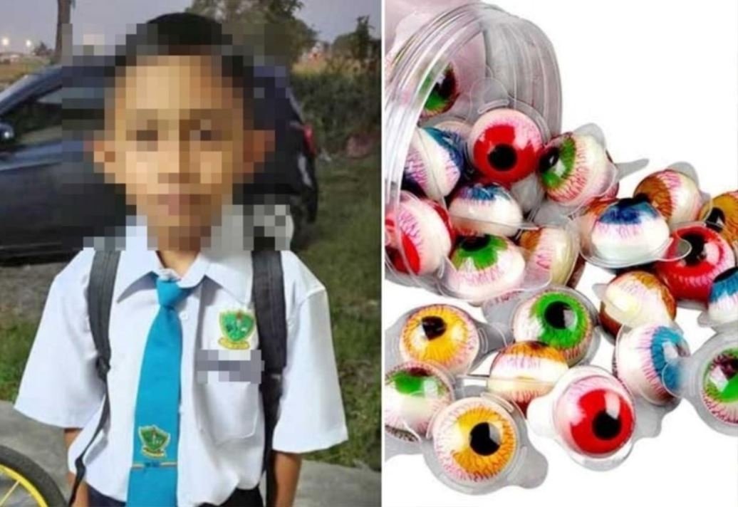 Ăn kẹo dẻo hình nhãn cầu mua ở cổng trường, cậu bé 10 tuổi tuvong thương tâm