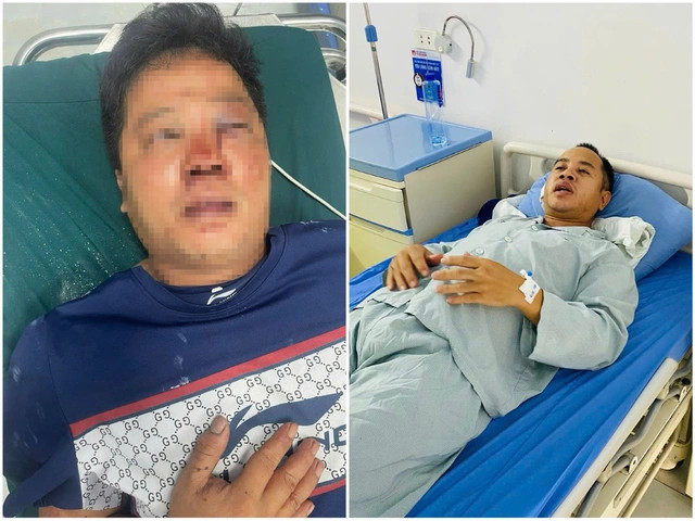 Danh tính đối tượng hanh:hung dã man 2 anh em giúp người gặp nạn