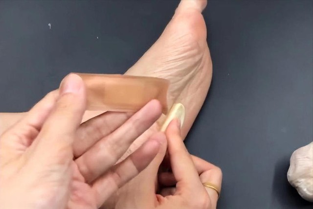 Người phụ nữ 56 tuổi dán tỏi vào lòng bàn chân suốt 6 tháng, kết quả khám sức khỏe khiến bác sĩ “ngã ngửa”